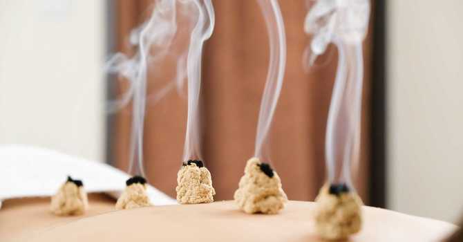 Moxibustion